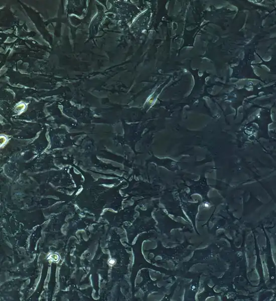 GS-441524 Injection use | Shaanxi BLOOM Tech Co., Ltd GS-441524 Injection use | Shaanxi BLOOM Tech Co., Ltd